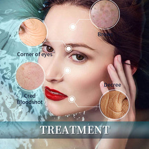 Greenlife No-Needle Mesotherapy Device Advance Hydro Water Device - Greenlife - Skin Care Machine