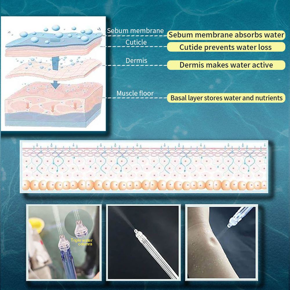 Greenlife No-Needle Mesotherapy Device Advance Hydro Water Device - Greenlife - Skin Care Machine